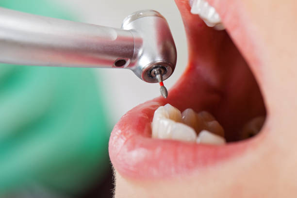 Best Dentist for Tooth Abscess  in Berwyn, PA